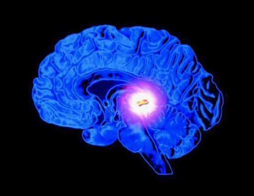 glandula pineal